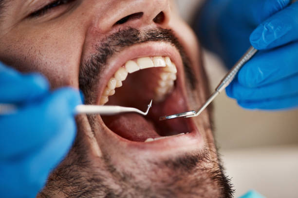 Best Emergency Broken Tooth Repair in Calverton, NY